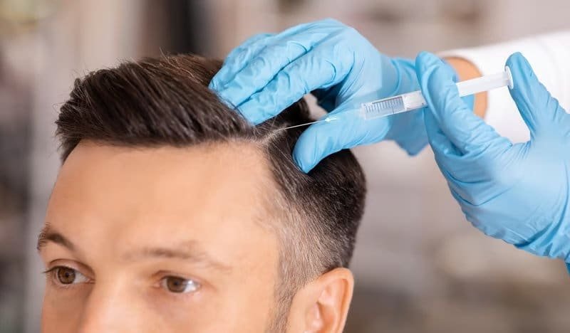 Physician performing a PRP scalp injection for hair restoration